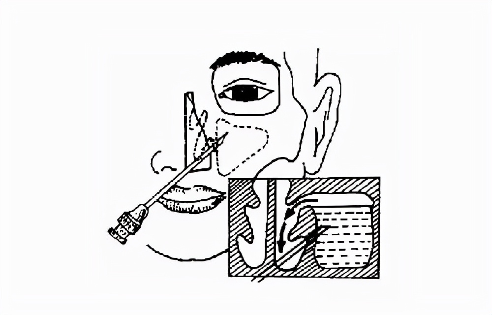 鼻塞头痛浓鼻涕是什么症状,鼻塞有黄鼻涕头痛是什么感冒