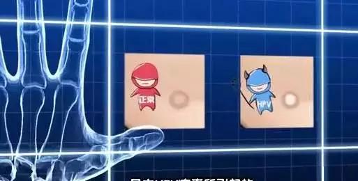 宫颈癌中毒的表现,宫颈癌忌烟酒吗