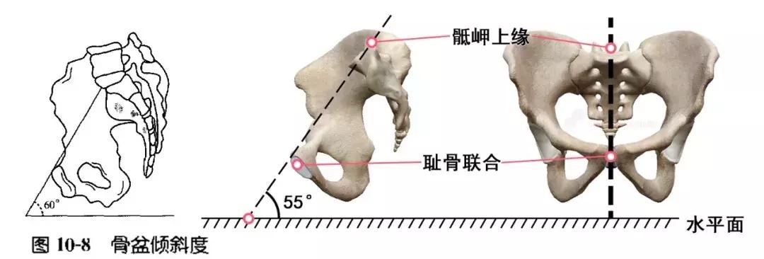 正美体态矫正骨盆旋转,正骨盆前倾如何矫正