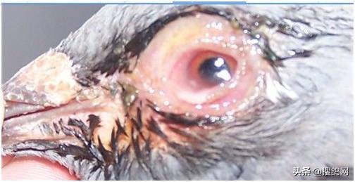 阿莫西林能治单眼伤风吗,巧用人药治单眼伤风