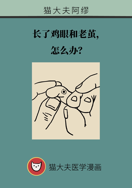 长了鸡眼该怎么办四大妙招教给你,长了鸡眼怎么治疗好得快