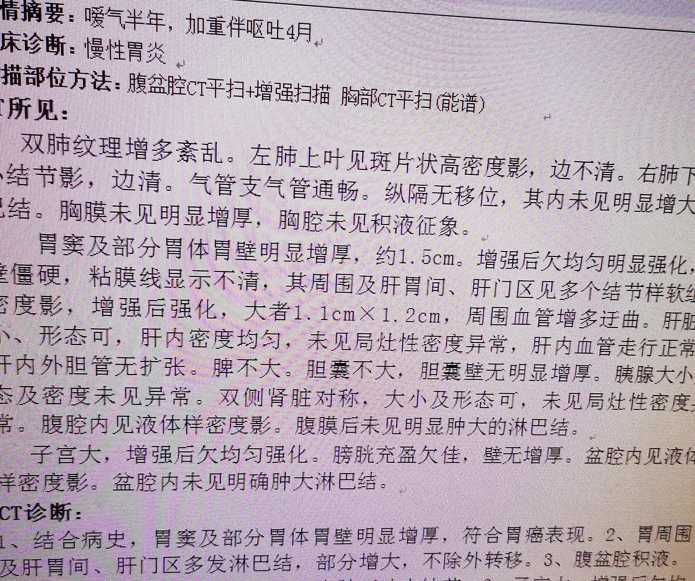 39岁女人胃癌晚期,40岁女人胃癌晚期症状