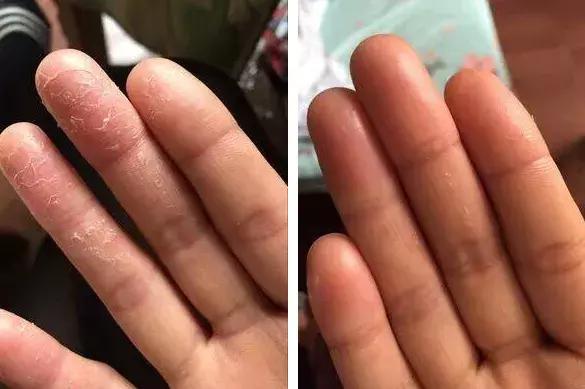 李佳琦卖断货的国货,李佳琦凡士林晶冻唇膏