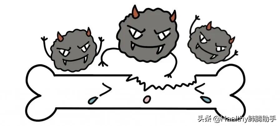 肺癌脑转移六七处,如何确认肺癌骨转移