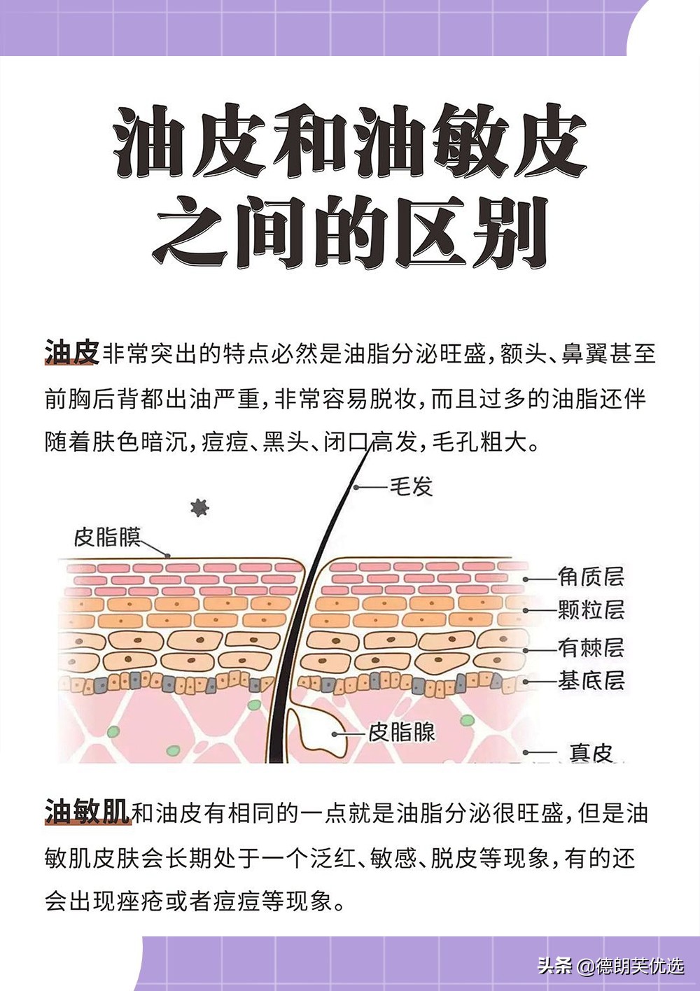 油敏肌脸上突然泛红急救措施,油敏肌饮食上怎么修复皮肤屏障