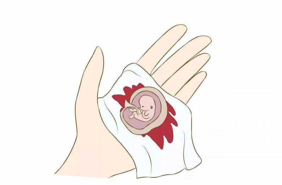 月经量超过80ml就不正常了吗,每次月经量少都是褐色的