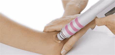 网球肘是否常见肘前外侧痛,网球肘能引肘关节和肩关节疼痛吗