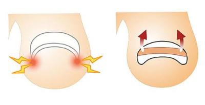 怎么治疗甲沟炎不让往肉里长,快速治疗甲沟炎的小妙招