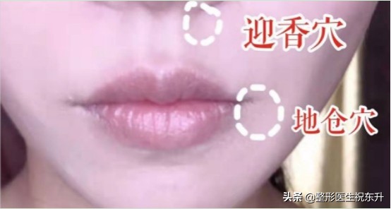 法令纹严重怎么办30岁,中年人怎么去除法令纹