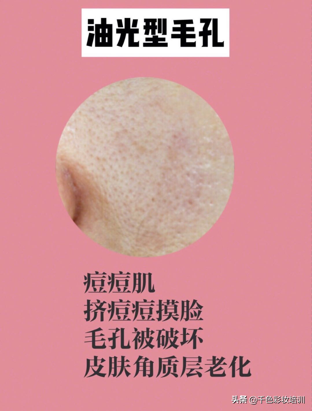 毛孔粗大怎么办怎么有效收缩毛孔,毛孔粗大怎么办教你几招收缩毛孔