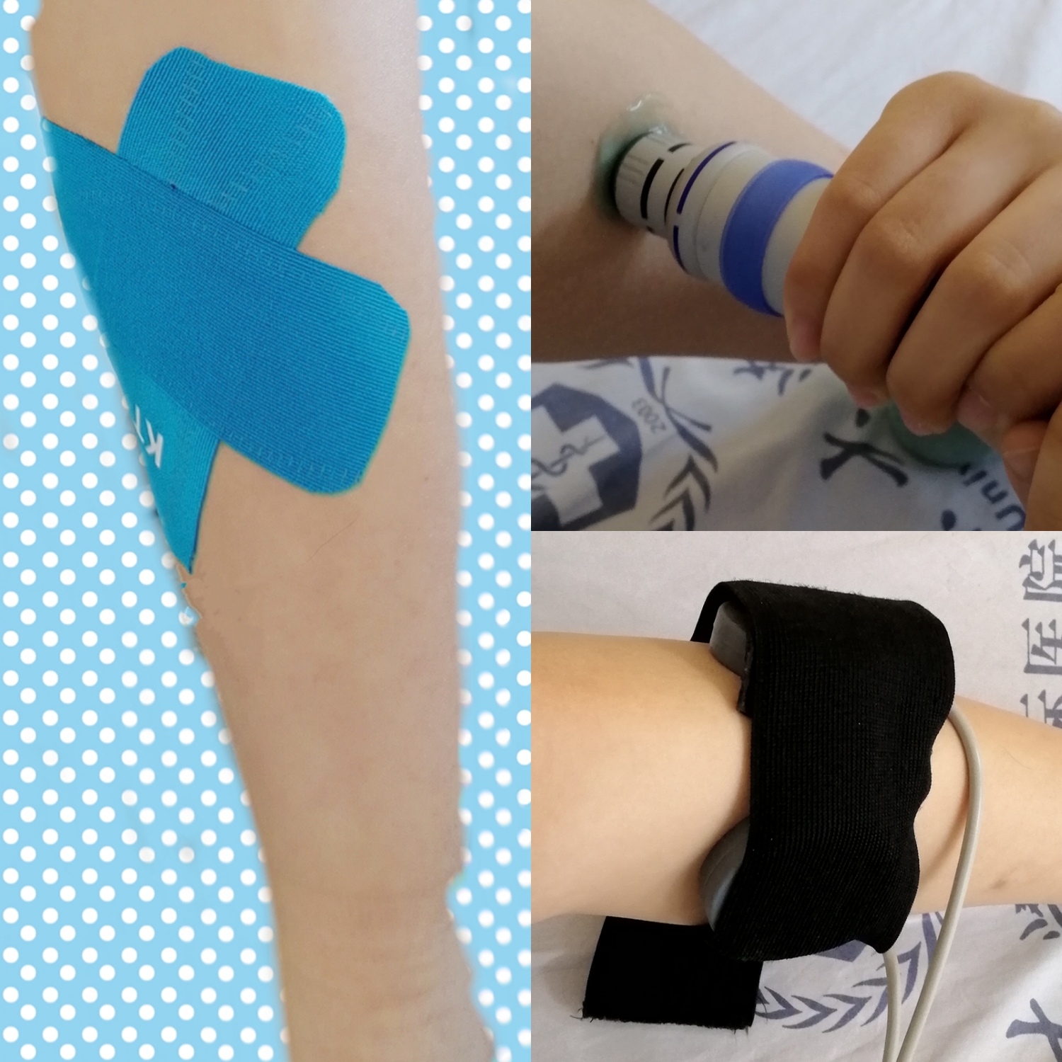 运动完小腿前侧肌肉疼是怎么回事,运动时小腿前侧肌肉酸痛怎么解决