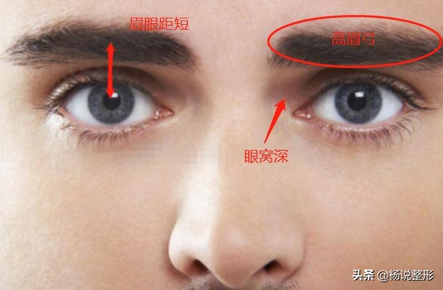 割双眼皮一定好看吗,割双眼皮真的好看吗