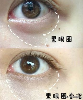 雅诗兰黛眼霜去细纹效果怎么样,雅诗兰黛祛眼纹吗