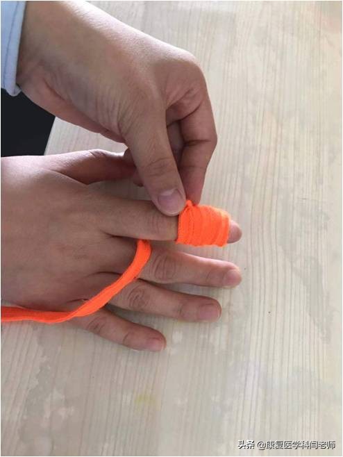 脑卒中后偏瘫患者常见并发症:肩手综合征的康复治疗