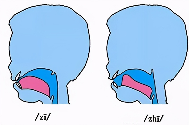 2岁剪舌系带还来得及吗,4岁小孩吐字不清跟舌系带有关吗