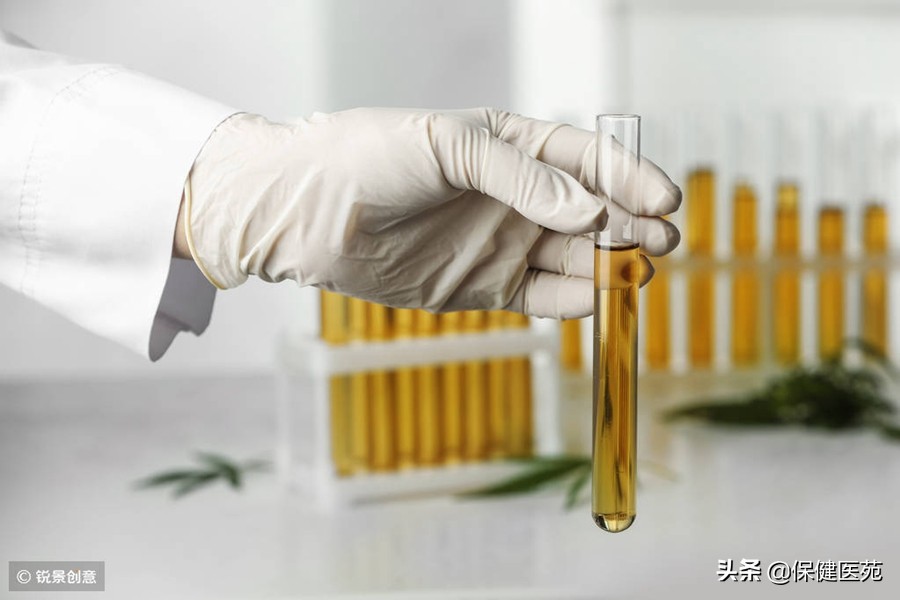 如何正确的留取小便标本,正确留取尿标本检查汇总表