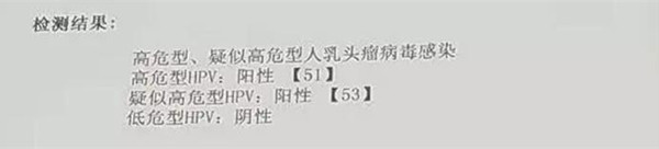患者发现hpv,28岁感染hpv58