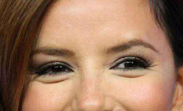 眼尾纹去皱纹效果好吗,有眼尾纹怎么办