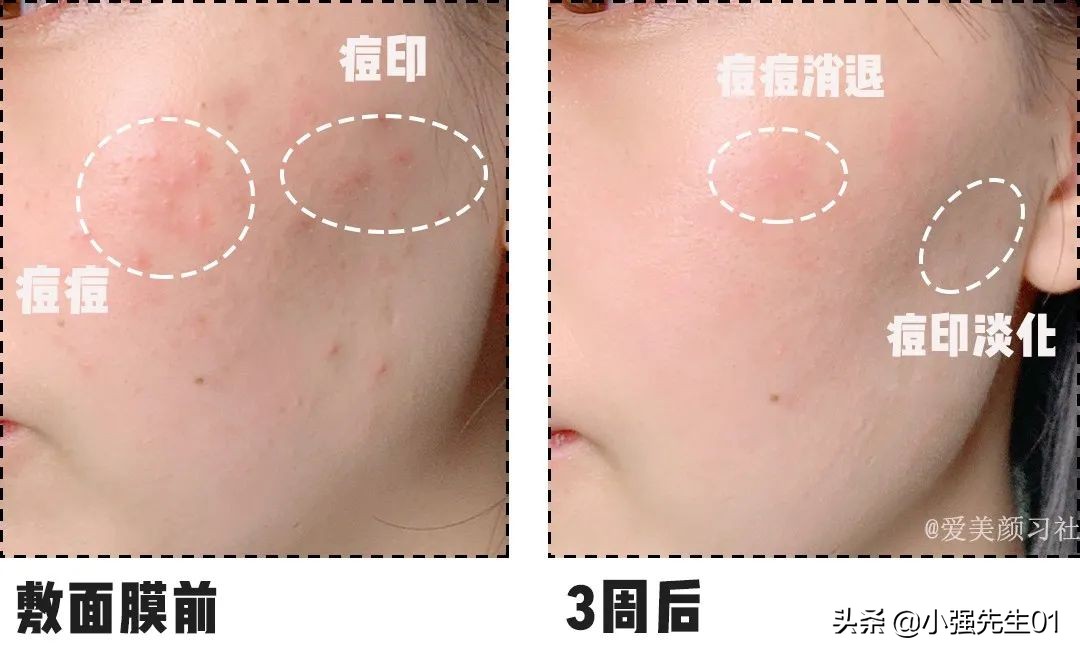 看完这些廉价面膜你还敢买吗,便宜又烂脸的面膜有哪些