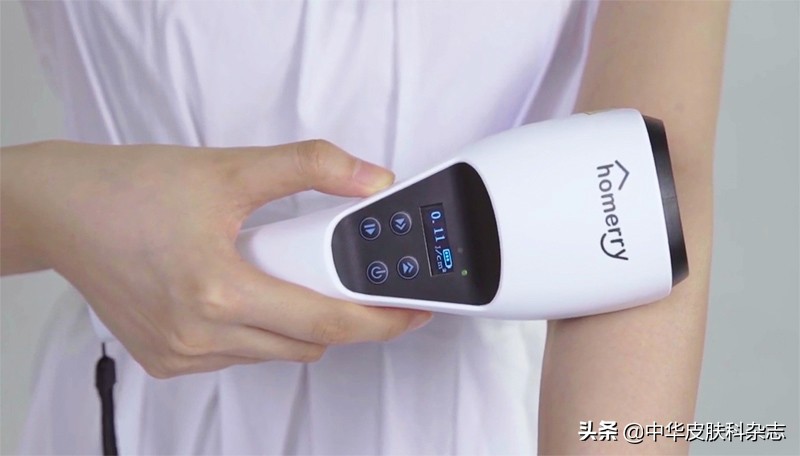 白癜风光疗用什么灯,白癜风家用光疗效果好吗