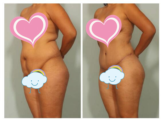 收紧腹部肌肉再现小蛮腰,如何让腹部肌肉快速塑形