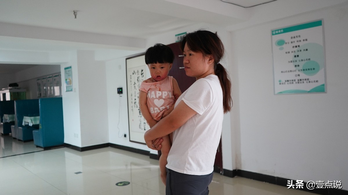 意外毁容真实案例,因为一次意外毁了女孩的一生