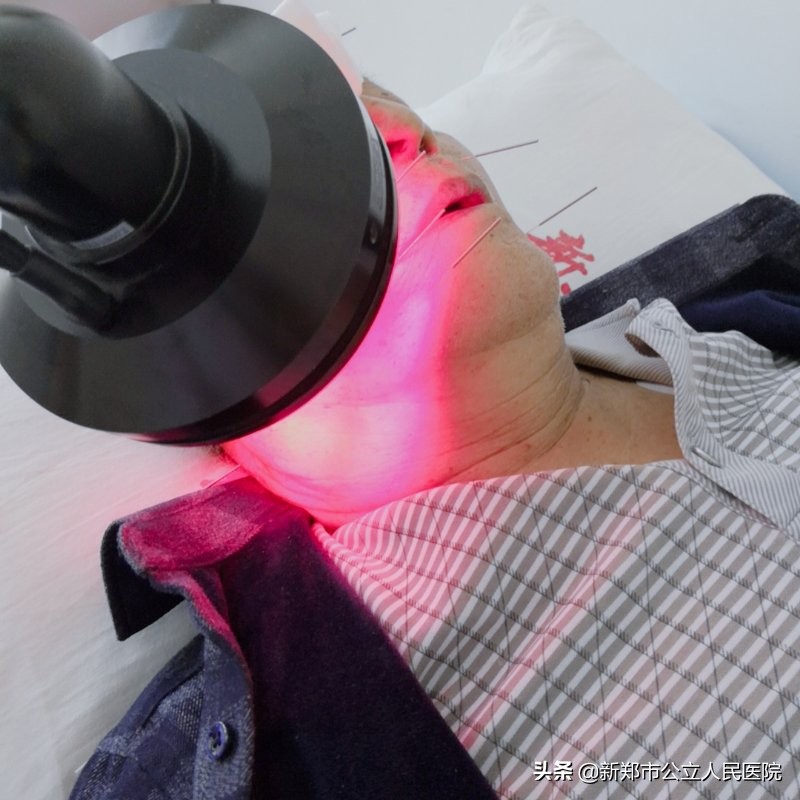 面瘫不是想得就得的,面瘫一点风都不能吹吗