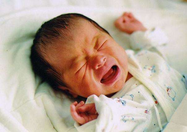 妈妈发现孩子有点黄怎么办,宝宝身上长了个大大的黑头