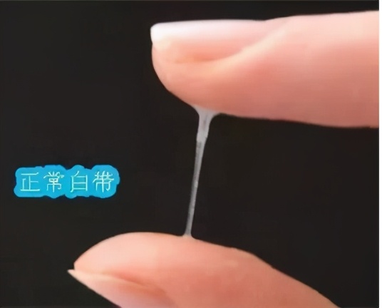 怎么样才会出白带,什么样的白带才正常