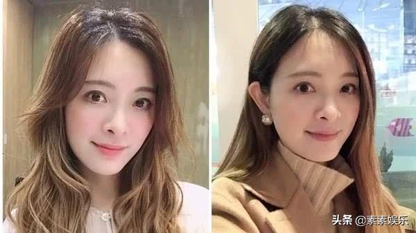 刘真病发及手术情况,刘真病情恶化视频