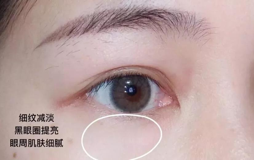 雅诗兰黛小棕瓶对比兰蔻菁纯眼霜,雅诗兰黛小棕瓶眼霜与兰蔻小黑瓶