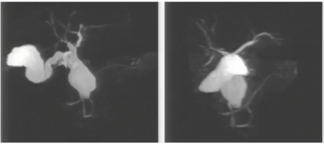 腹部ct详细讲解,腹部ct示意图及超详细教学