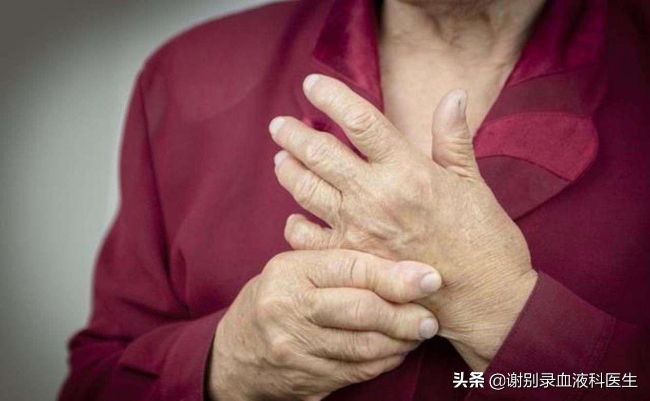 紫癜肾炎拖久了会很严重吗,紫癜严重了是什么后果