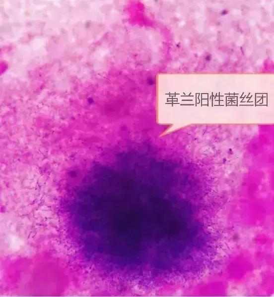 他摸了出土*物文**,然后住院八次