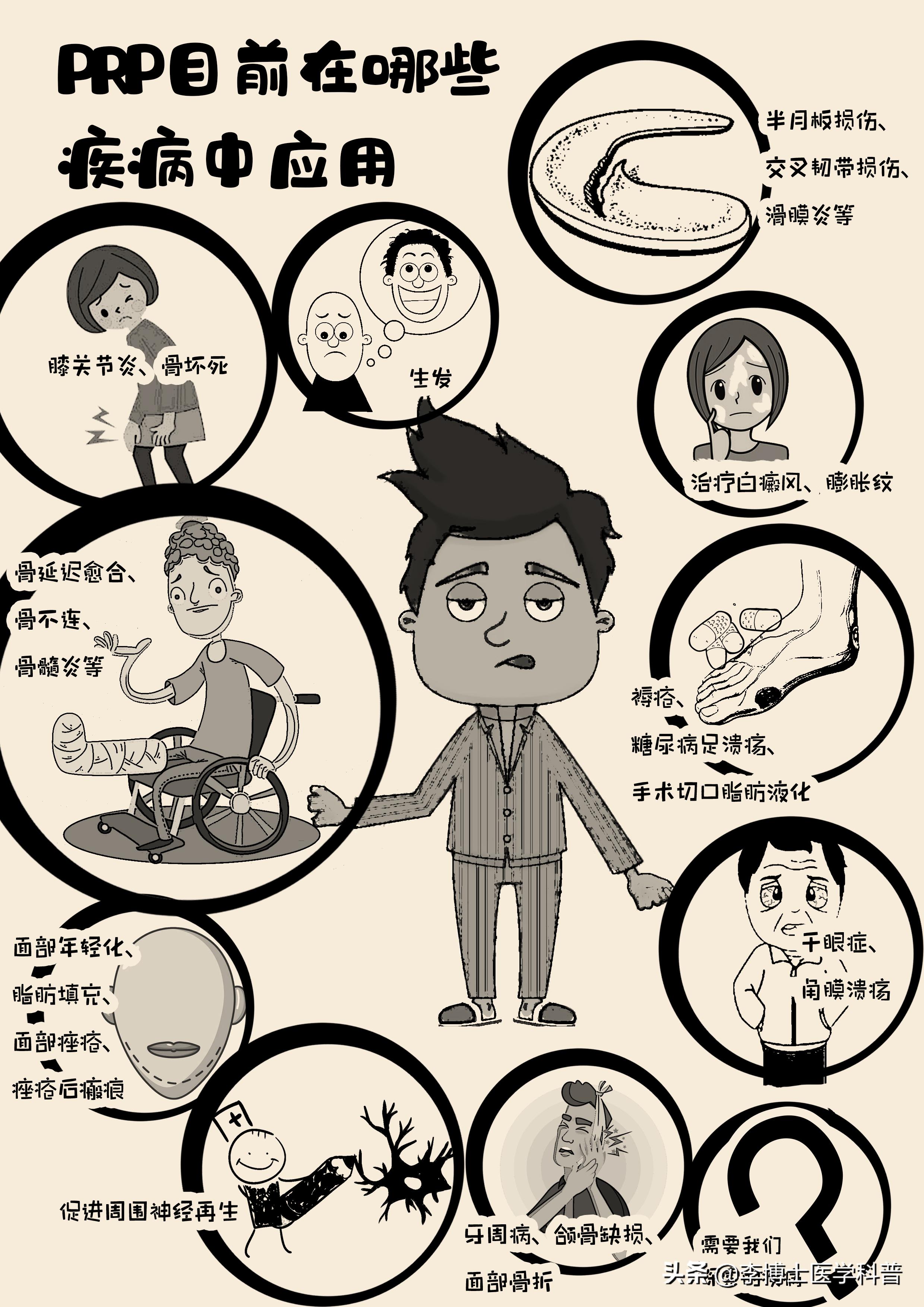 什么是富血小板血浆PRP治疗,富血小板血浆的主要作用是什么