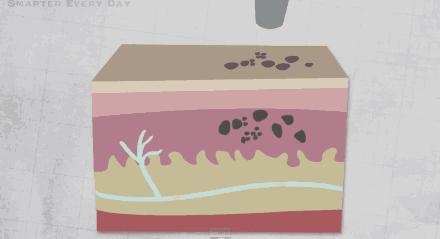 美容祛斑原来这么简单,祛斑算是整容吗