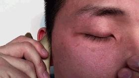 眼袋是气虚的表现吗怎么消除,脾虚眼袋大怎么去除眼袋