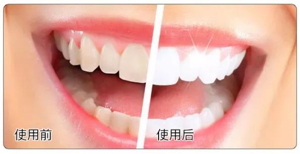 去除牙黄口臭牙膏实验,酵素牙膏去烟渍美白牙结石