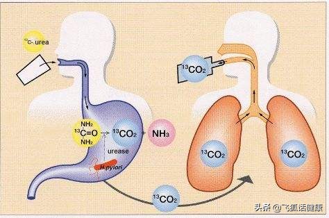 幽门螺杆菌hp参数,幽门螺杆菌hp阳性怎么治疗