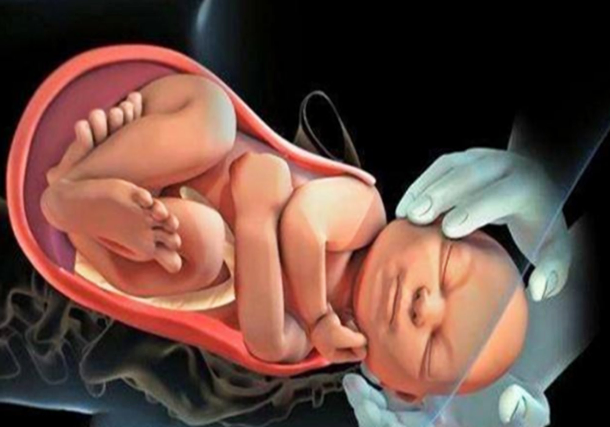 顺产开十指每开一指有多疼,顺产宫口开十指是什么意思