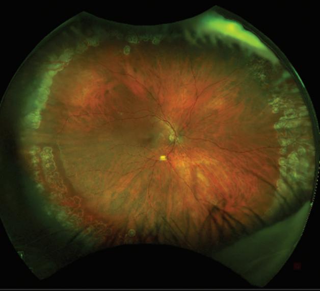 对眼药水过敏怎么办,对眼药水过敏怎么解决