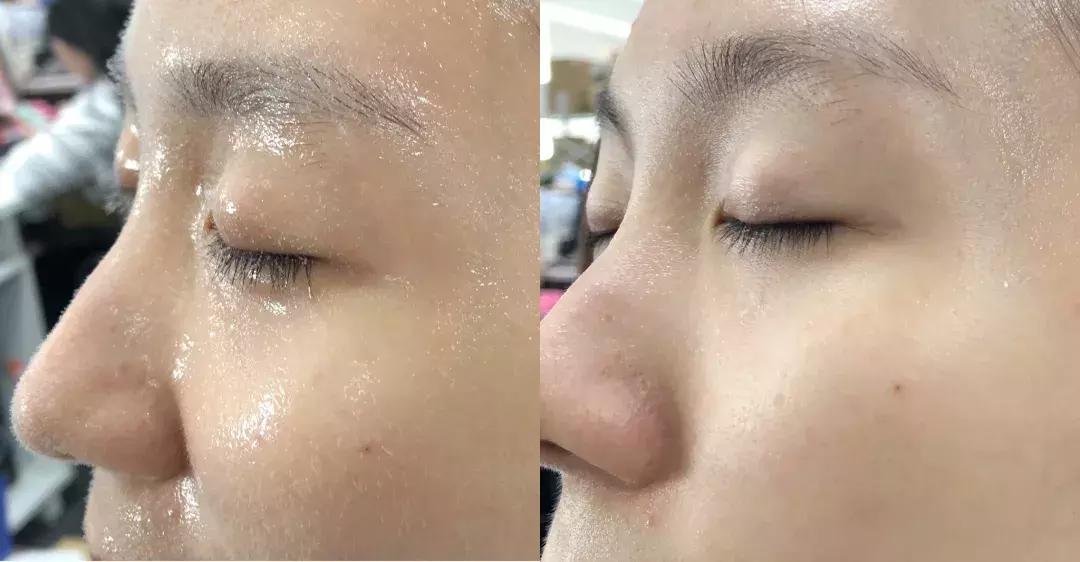 有了前法国第一夫人的百元“黑科技”眼霜，我把3000块眼霜扔了！