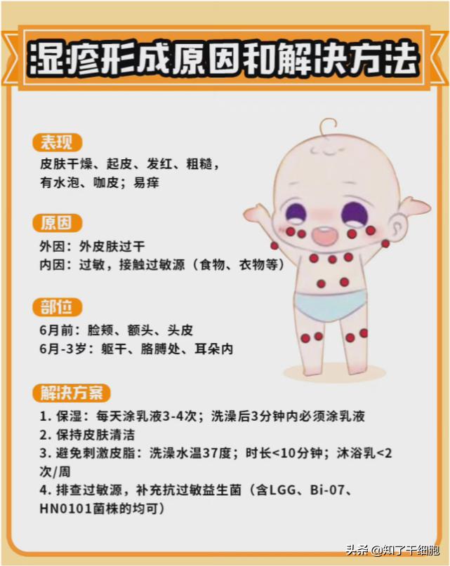 宝宝眼睛周围长湿疹要如何护理,孩子得了湿疹该怎么做好皮肤护理