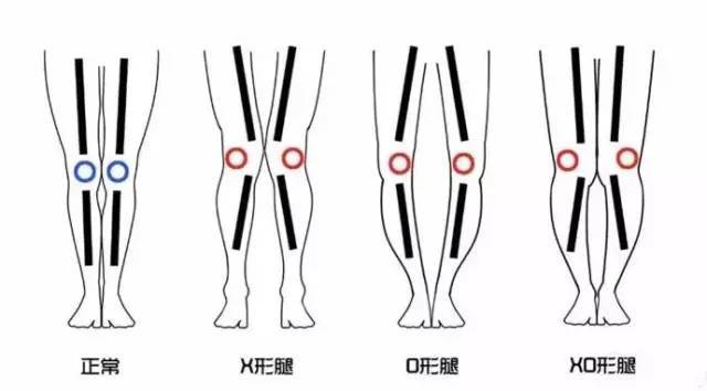 修饰腿型裤子推荐男生,粗腿如何选裤子男士穿