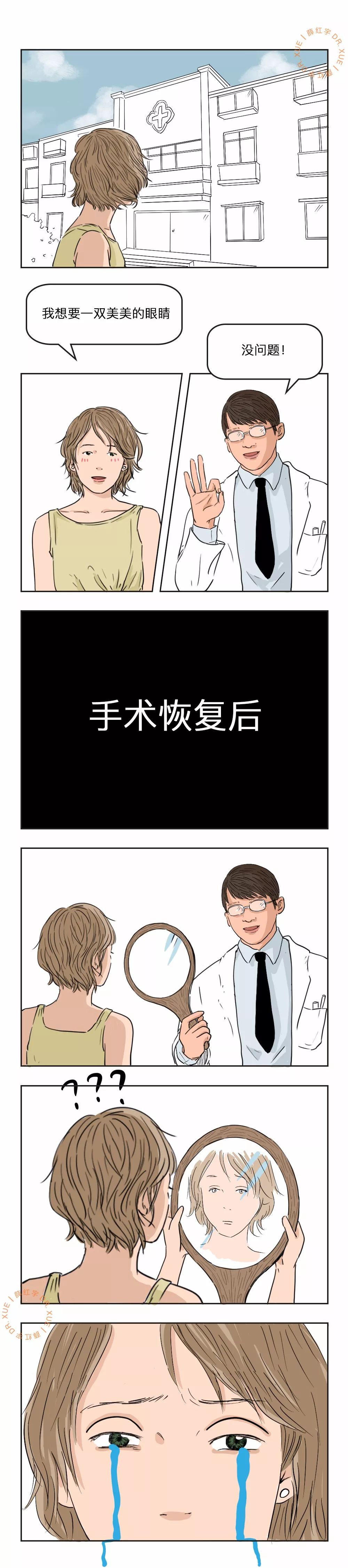 双眼皮整形修复,潘贰双眼皮修复