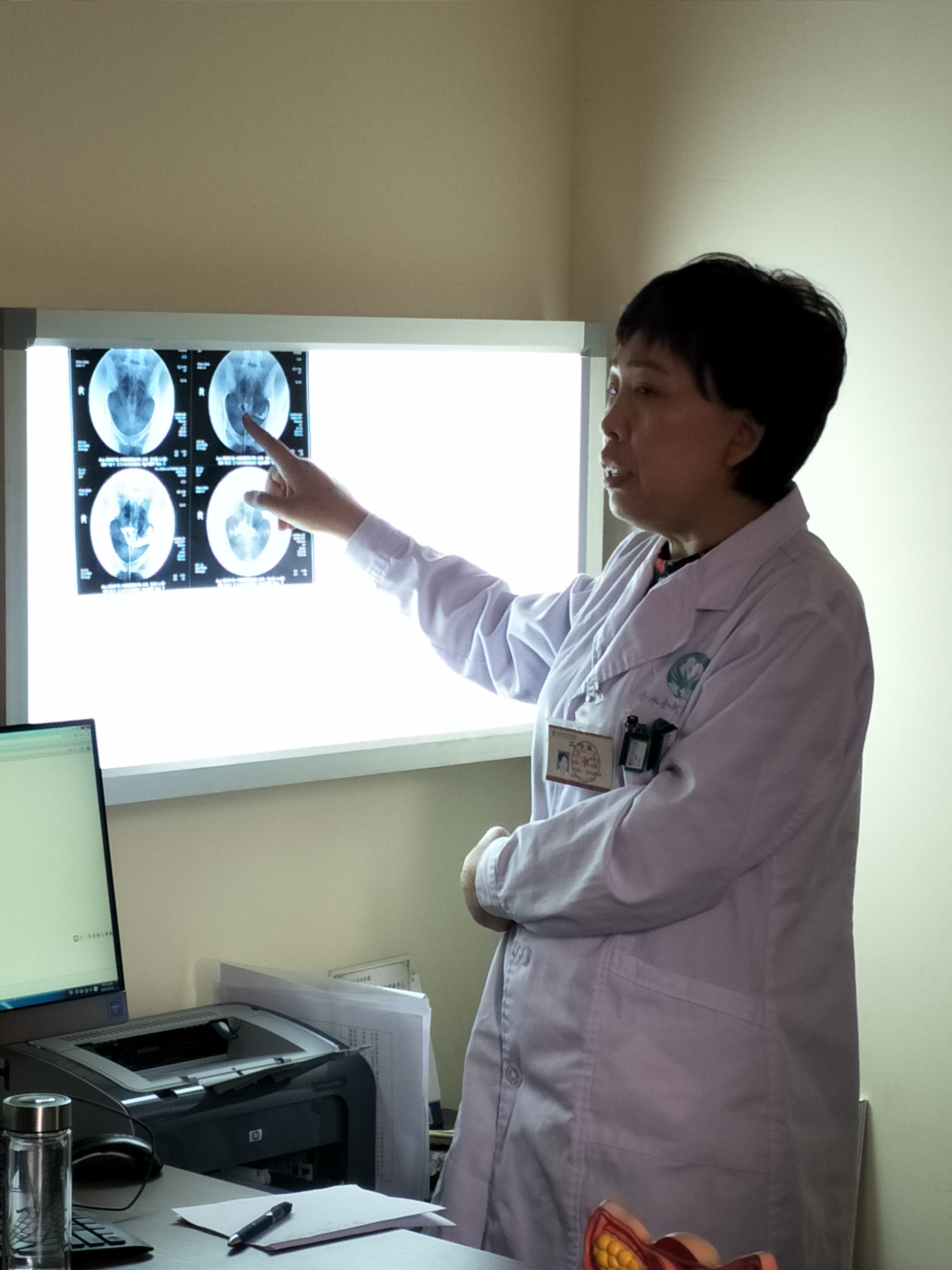 排卵试纸正常输卵管正常吗,附件正常说明输卵管正常吗