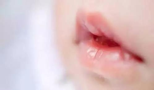 Lucar小课堂|春季干燥,做好孩子的唇部护理,简单!