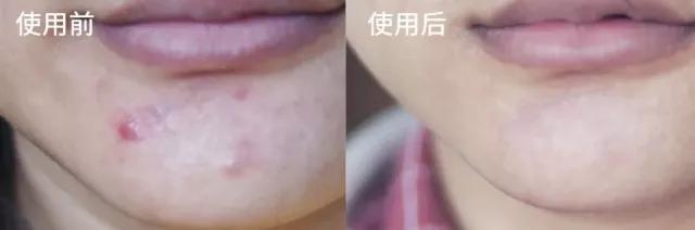 最强蜂胶,超级天然蜂胶