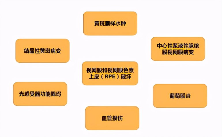 黄斑病变特效药配方,治疗黄斑病变最好的偏方