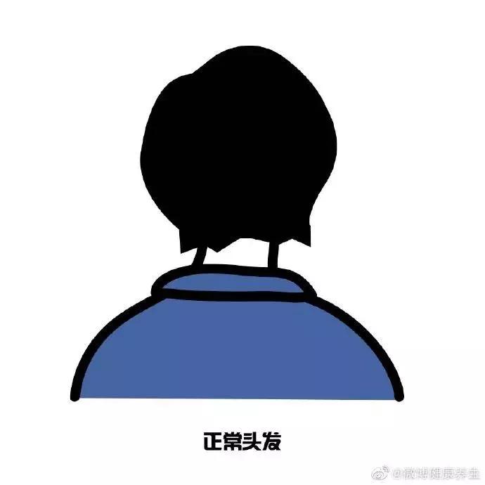 我国超2.5人脱发,中国有多少人脱发